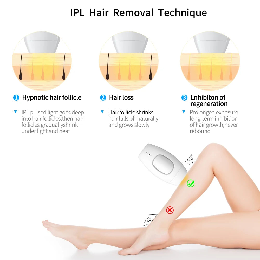 Laser Epilator Hair Removal Laser Epilator Hair Removal