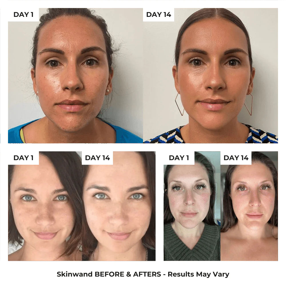 4-in-1 Skincare Wand with Red Light Therapy 4-in-1 Skincare Wand with Red Light Therapy