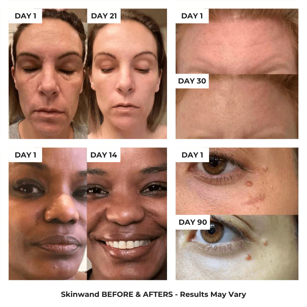 4-in-1 Skincare Wand with Red Light Therapy 4-in-1 Skincare Wand with Red Light Therapy